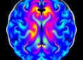 Dual-frequency photoacoustic imaging maps vessels and oxygenation across the mouse brain