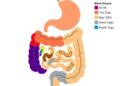 Early-Onset Inflammatory Bowel Disease Advances, Yet Health Inequities Persist
