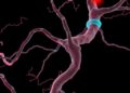 FOXK2 discoveries broaden understanding of cancer biology and clinical care
