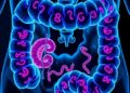 GNG10 Drives Colorectal Cancer Through Non-Canonical Wnt Signaling