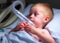 High inspired oxygen before extubation tied to children’s postoperative atelectasis, trial finds
