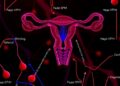 How SHH-Wnt crosstalk, DNA methylation, and miRNAs drive uterine fibroids