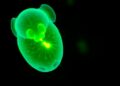 Hypercontractile embryos from older female mice experience implantation failure