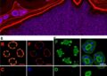 IL-1 Signaling Strengthens Mucosal Defense Against Systemic Candida albicans Infection