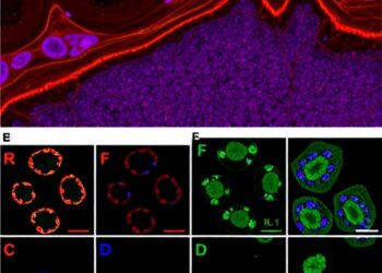 IL-1 Signaling Strengthens Mucosal Defense Against Systemic Candida albicans Infection