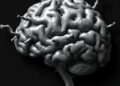 Idiotypic-Susceptible Alzheimer’s Disease Identified as Clinically Relevant Neurofibrillary Tangle Subtype