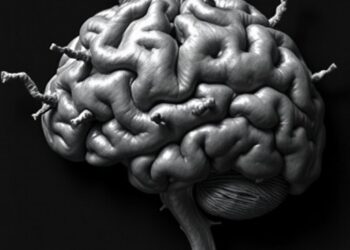 Idiotypic-Susceptible Alzheimer’s Disease Identified as Clinically Relevant Neurofibrillary Tangle Subtype