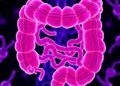 Japanese Colorectal Cancer Reveals Prevalence, Timing, and Microbiome Signatures of Colibactin Mutations