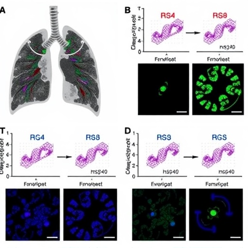 Levistilide A Drives Ferroptosis via RNF40-HSP90α Axis, Suppressing