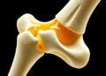 Manuka Honey and Oregano Oil Boost Antibacterial Protection in 3D-Printed Bone Scaffolds