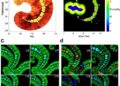 Metabolic mapping reveals spatially distinct host carbon reprogramming during Trichinella spiralis infection