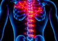 Mitochondria-Targeted Therapy Shows Promise Against Intervertebral Disc Degeneration