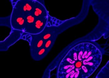 Monocyte-derived IL-1β/p65/KRT7/ILK pathway drives epithelial–mesenchymal transition in colorectal cancer