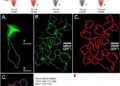 Multi-database study identifies cervical cancer targets tailored to tumor subtypes