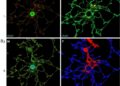 Multiple Myeloma Cell Lines Reveal Clonal Heterogeneity Across One Patient’s Disease Course