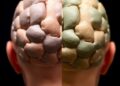 Natural or Synthetic Grafts: Which Is Better for Cranial Duraplasty?