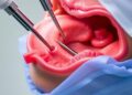 New Advances in Minimally Invasive Laryngeal Surgery