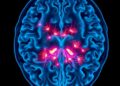 New Imaging Technology Captures Seizures as They Happen