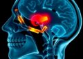 New technique assesses reliability of imaging measurements guiding medical decisions