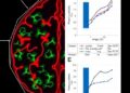 Parkinson’s-linked LRRK2 mutation disrupts astrocyte development and induces senescence-like changes