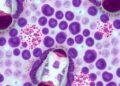 Peyer’s patch M cells sustain epithelial group 3 innate lymphoid cells, IL-22