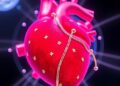 Pressure-pH Responsive Coating Enables Instant High-Dose Paclitaxel Delivery During Angioplasty