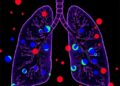 Progenitor T Cells Fuel Chronic Type 2 Inflammation in the Lungs