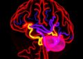 Protein Thiol Changes Promote Harmful Liquid–Liquid Phase Separation in Aging Brains