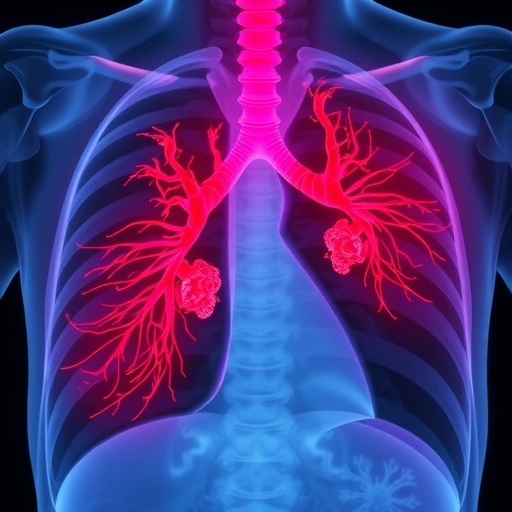 Pulmonary cryptococcosis emerges in diabetic, hypertensive patient without classic immunodeficiency