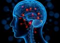 Real-world study examines psychotic complications of subcutaneous foslevodopa/foscarbidopa infusions in 198 patients