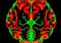 Regional reductions in high-energy phosphorus metabolites characterize cerebellar multiple system atrophy