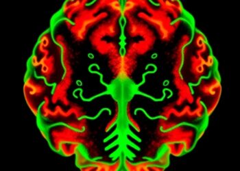 Regional reductions in high-energy phosphorus metabolites characterize cerebellar multiple system atrophy