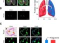 Rosiglitazone protects against renal ischemia-reperfusion-induced lung injury via HMGB1/MYH9-PPARγ pathway