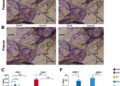 Scn1b/Gsdmd knockdown promotes M2-like macrophages, modulating inflammation and fibrosis in rat ARDS