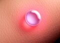 Smart Wearable Hydrogel Devices Promise Precision Drug Delivery Through Skin
