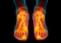Study finds AI could enable affordable foot health technology
