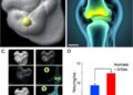Succinate Worsens Obesity-Linked Osteoarthritis Through SUCNR1 Activation, Succinylation, and Mitochondrial Dysfunction
