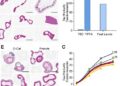 TIF1γ Maintains Regulatory T-Cell Stability During Inflammation