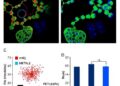 Targeting METTL3/m6A/SOCS3 Reprograms Macrophages, Boosting Anti-PD-1 Therapy in Multiple Myeloma
