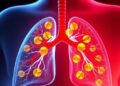 Targeting SIRT1-TLR4 Pathway Eases Oxidative Inflammation in Bronchopulmonary Dysplasia Cell Model