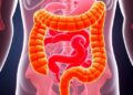 Targeting aryl hydrocarbon receptor signaling offers a promising strategy against necrotizing enterocolitis