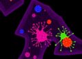 Tuft Cell-Like Tumors Reveal New Cancer Subtype With Distinct Biology, Treatment Potential