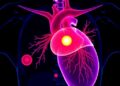 Unexpected Cardiac Tumor Diagnosed as Histiocytosis in Case Report