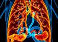 Urinary proteomics shows promise for congenital diaphragmatic hernia and Tetralogy of Fallot