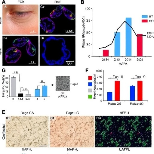 17(S)-HDHA counters UVB-induced skin aging via EGFR/MAPK pathway regulation