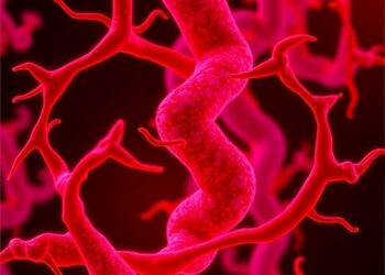 3′-Sialyllactose curbs atherosclerosis via gut-immune-cardiovascular axis in mice