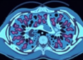 AI Learns to Read Cancer Slides Like a Pathologist by Watching the Neighborhood