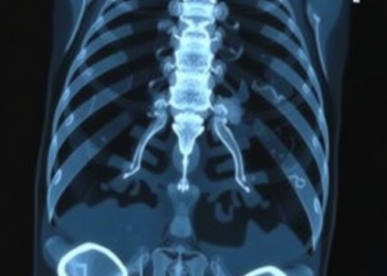 AI Learns to Read Fuzzy Bone Scans and Write Radiology Reports