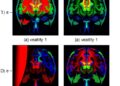 Bidirectional decoupled learning improves cross-subject emotion recognition from physiological signals
