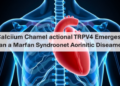 Calcium Channel TRPV4 Emerges as a Key Player in Marfan Syndrome Aortic Disease